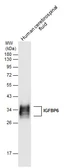 Anti-IGFBP6 antibody used in Western Blot (WB). GTX130836